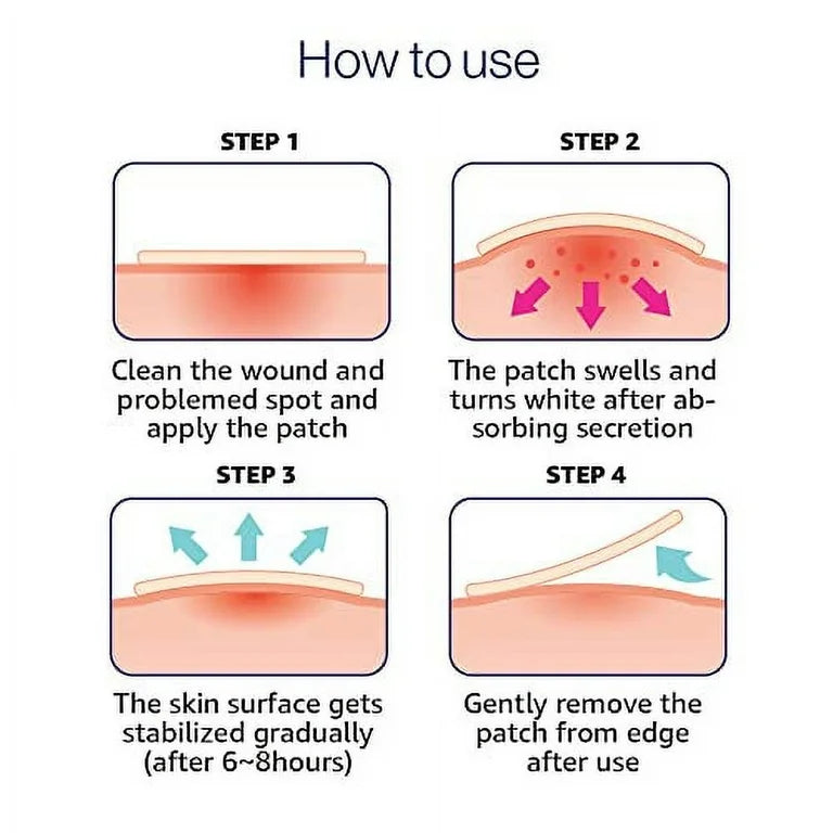 Hydrocolloid Acne Patches